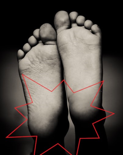 Heel pain – How do we find relief?