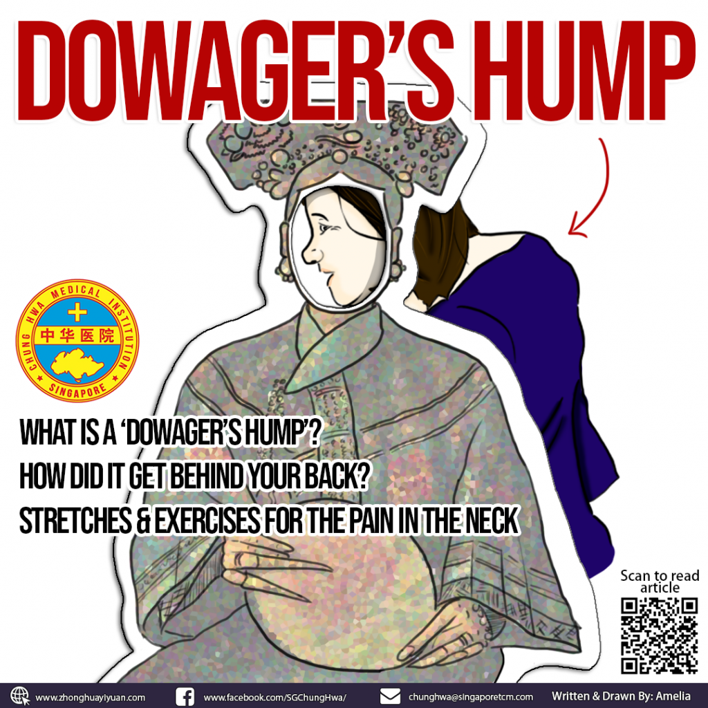 What is a ‘Dowager’s Hump’?